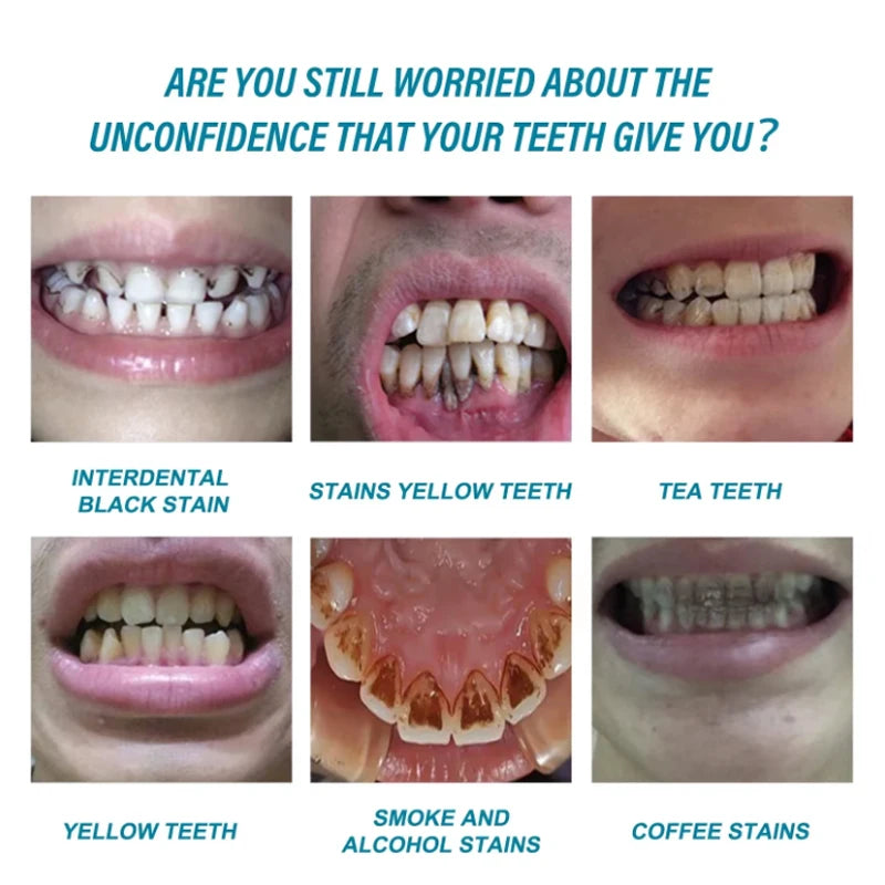 Niacinamide whitening dual-color toothpaste freshens breath, cleans the mouth, and removes yellowing and stains