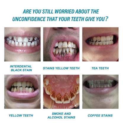 Niacinamide whitening dual-color toothpaste freshens breath, cleans the mouth, and removes yellowing and stains