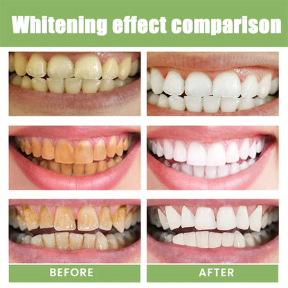 Niacinamide whitening dual-color toothpaste freshens breath, cleans the mouth, and removes yellowing and stains