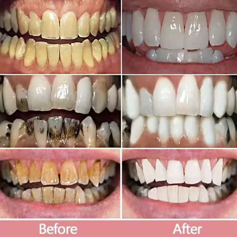 Niacinamide whitening dual-color toothpaste freshens breath, cleans the mouth, and removes yellowing and stains