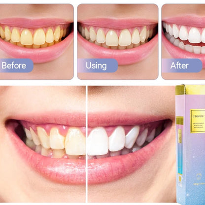 Niacinamide whitening dual-color toothpaste freshens breath, cleans the mouth, and removes yellowing and stains